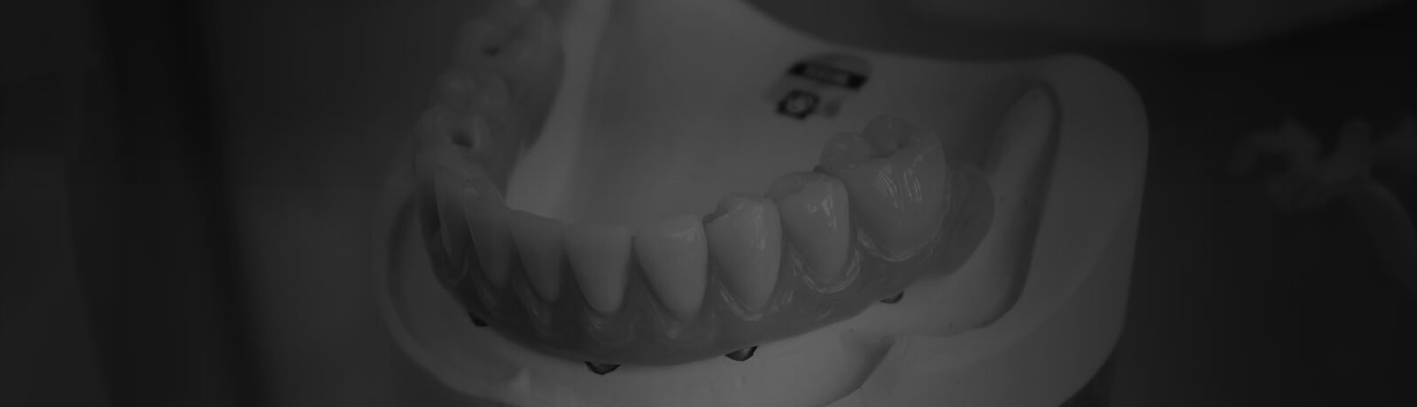 Complex Restorative/Removable
