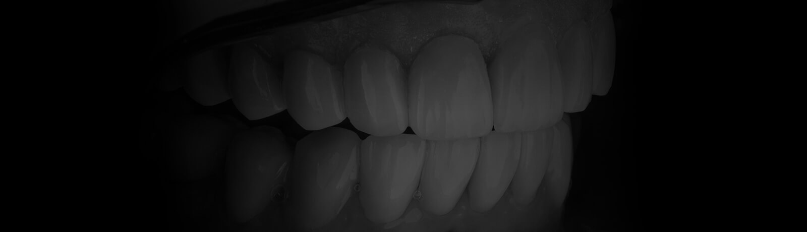 Cosmetic Dentistry