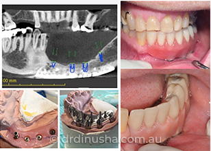 case1