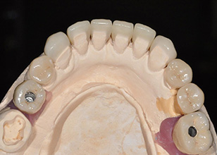 case2