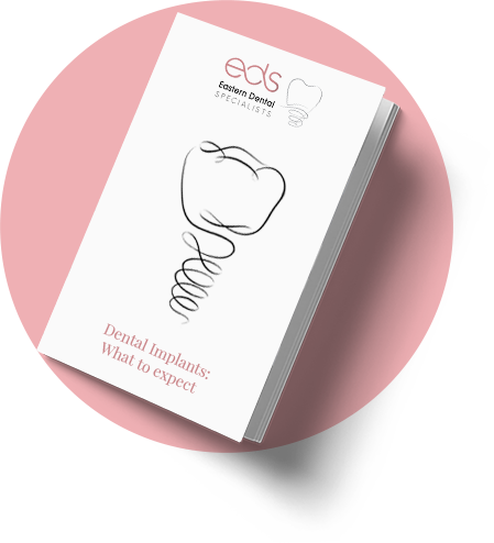 Download our Dental Implants Guide
